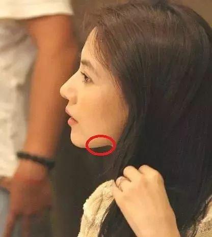 明星的下颌线,打造完美轮廓的秘密武器